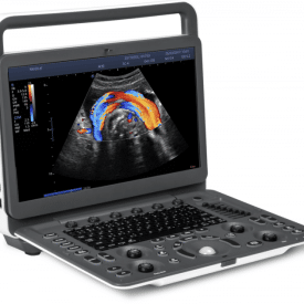 SonoScape E Pro Ultrasound SonoScape E Pro Ultrasound