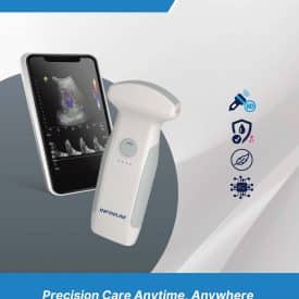 Inf SB VioScan C Convex Handheld Ultrasound Page