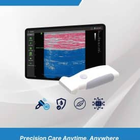 Inf SB VioScan L Linear Handheld Ultrasound Page